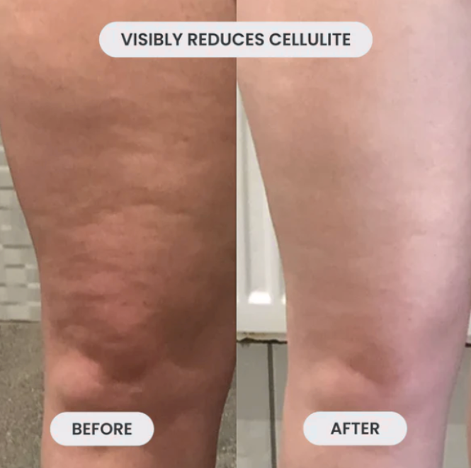 CelluFade Pro