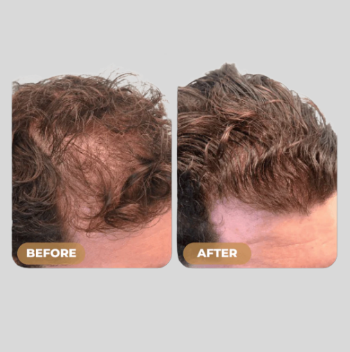 Root Activator Shampoo