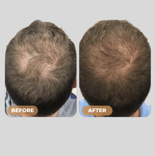Root Activator Shampoo