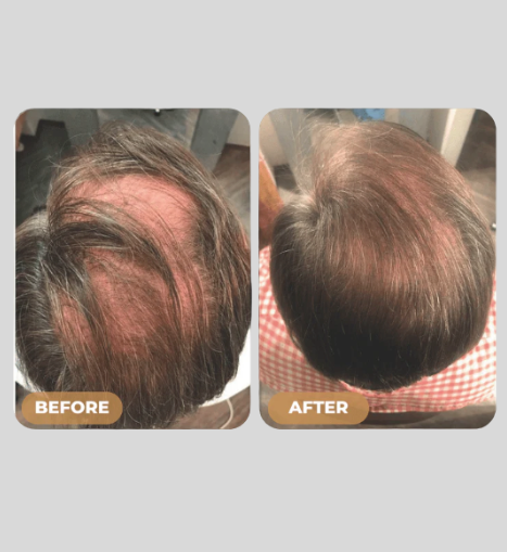Root Activator Shampoo