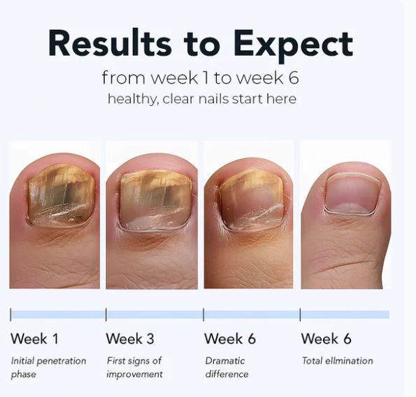 Nail fungus Removal Patches