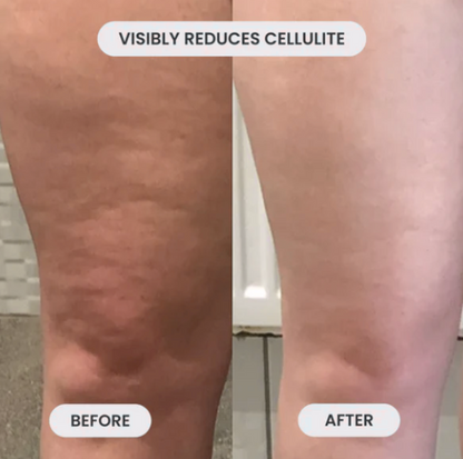 CelluFade Pro