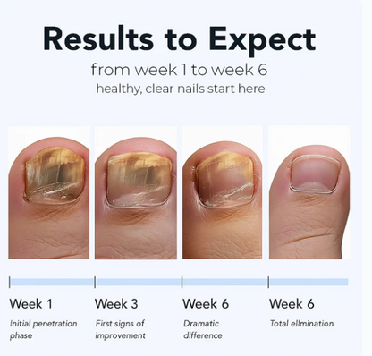 Nail fungus Removal Patches